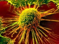 Ученые нашли раковые клетки с 11000-летней историей