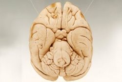 Найдена отвечающая за уникальность человеческого разума зона мозга