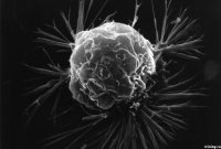 Убить своими клетками: томские ученые придумали, как лечить рак груди